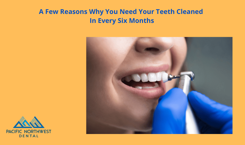 Featured image for “A Few Reasons Why You Need Your Teeth Cleaned In Every Six Months”