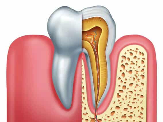 Root Canal Therapy In Beaverton, OR