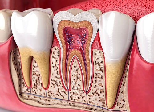 This image about root canal therapy