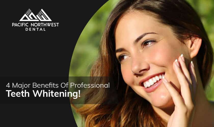 Featured image for “Know The 4 Major Benefits Of Professional Teeth Whitening!”