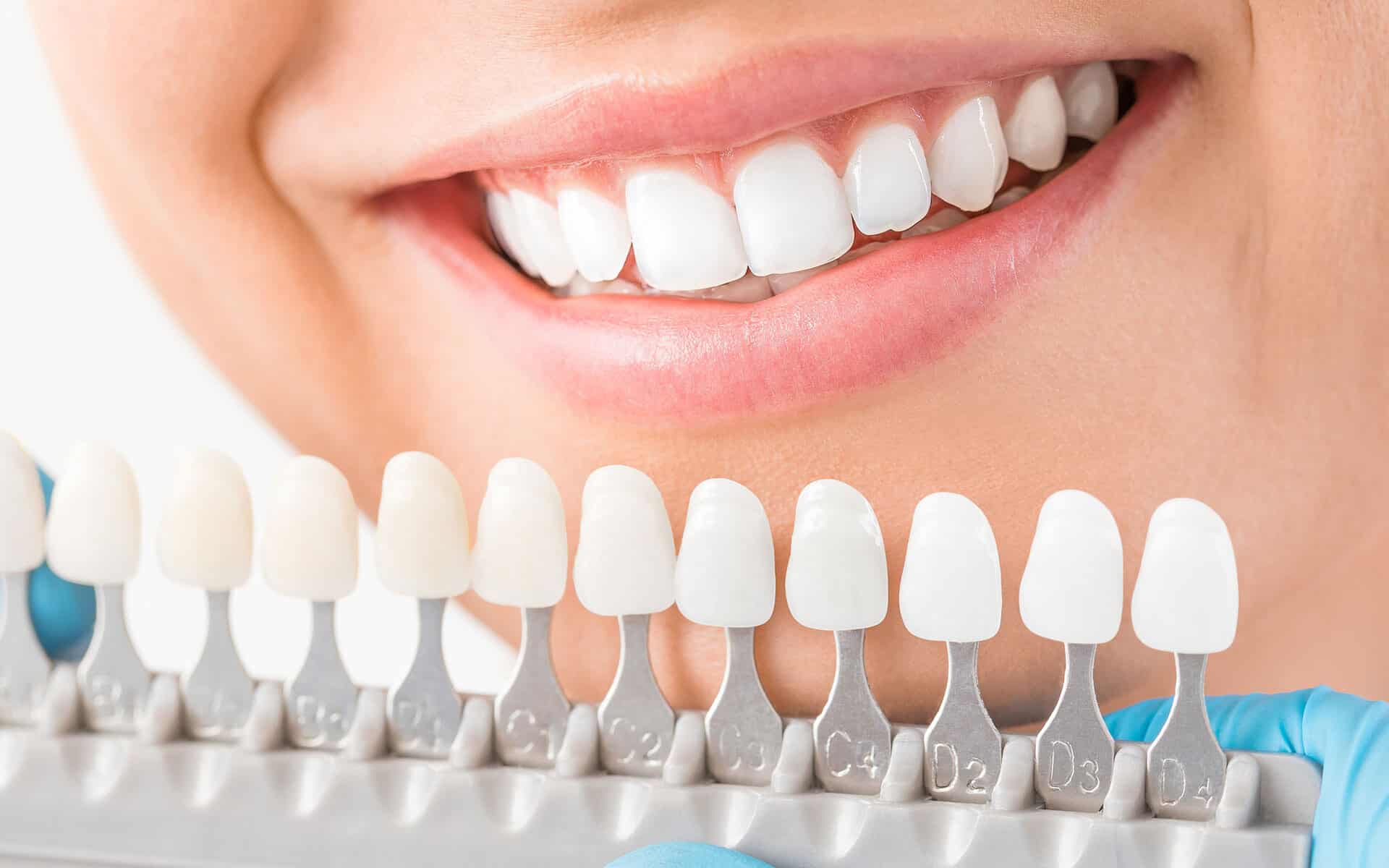 Featured image for “How to Find the Best Implant Dentist?”