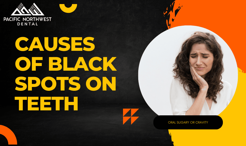 9 Causes Of Black Spots On Teeth