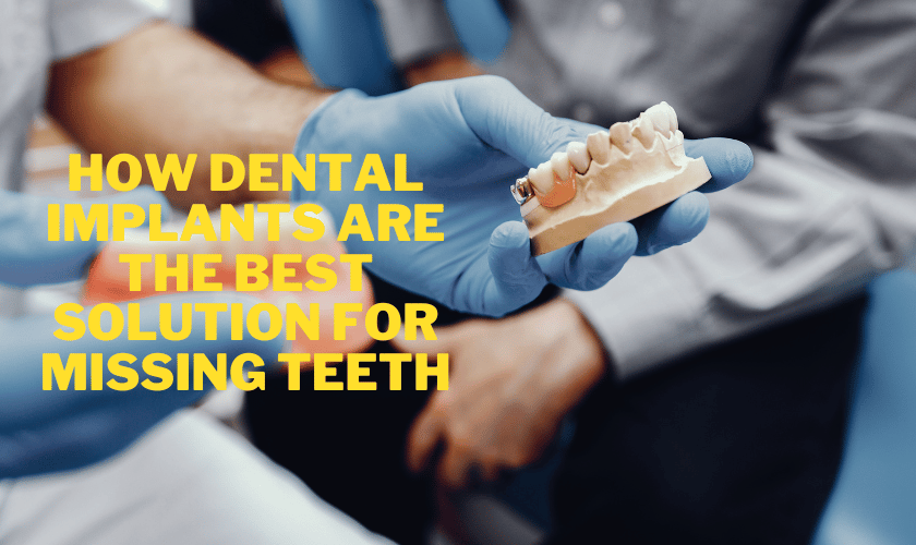 Featured image for “How Dental Implants are the Best Solution for Missing Teeth”