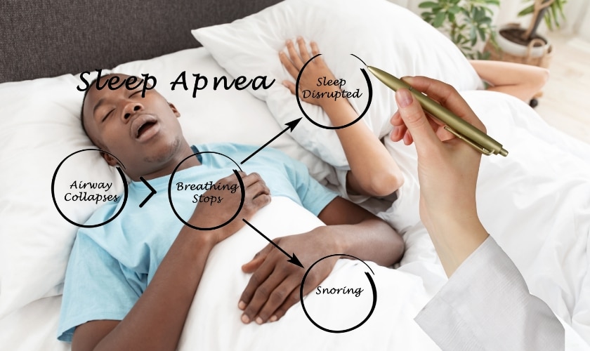 Fixing sleep apnea naturally