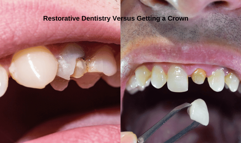 Featured image for “Benefits of Restorative Dentistry Versus Getting a Crown”