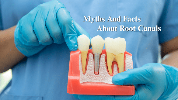 Featured image for “7 Myths And Facts About Root Canals”