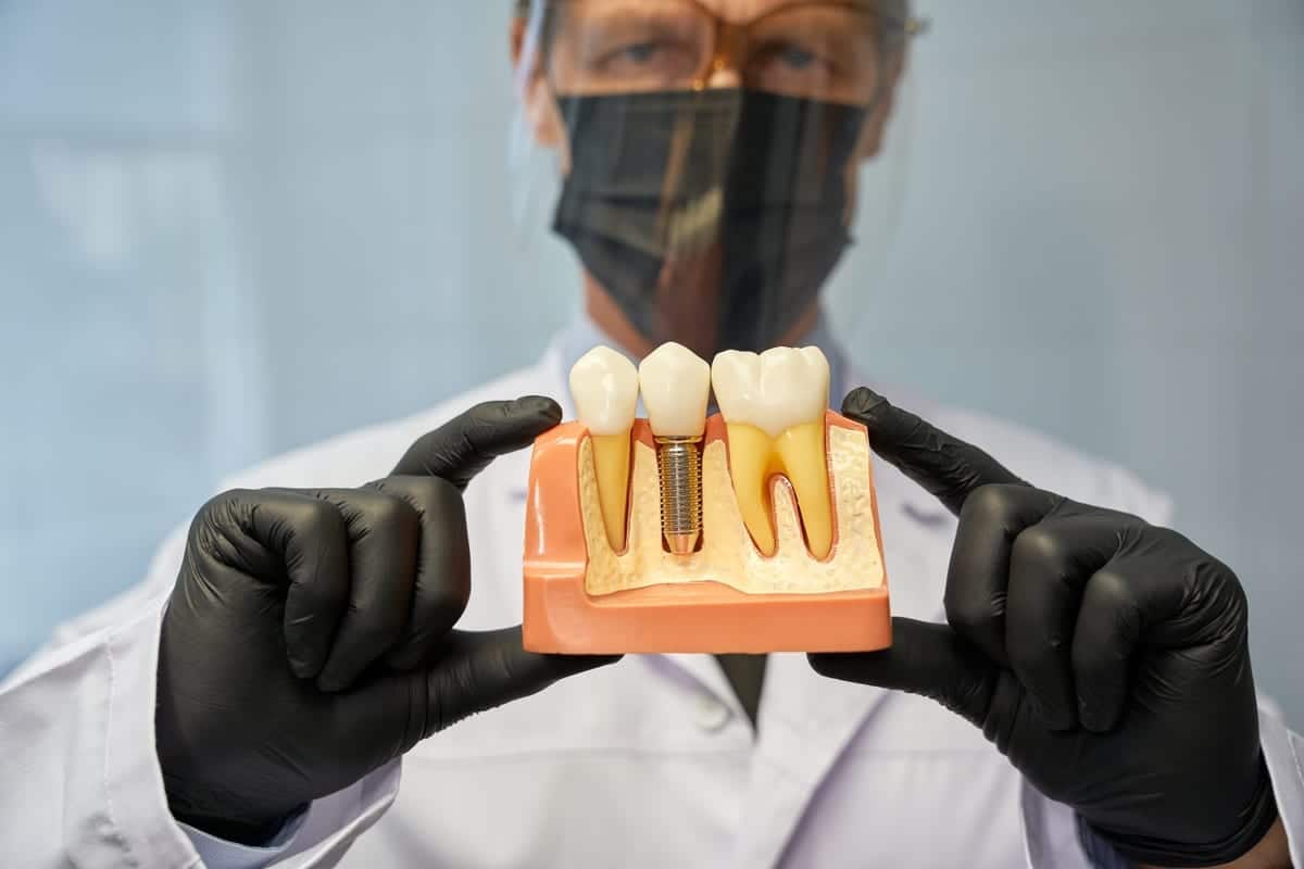 Featured image for “Dental Implant Recovery Timeline in Beaverton, OR | Pacific Northwest Dental”